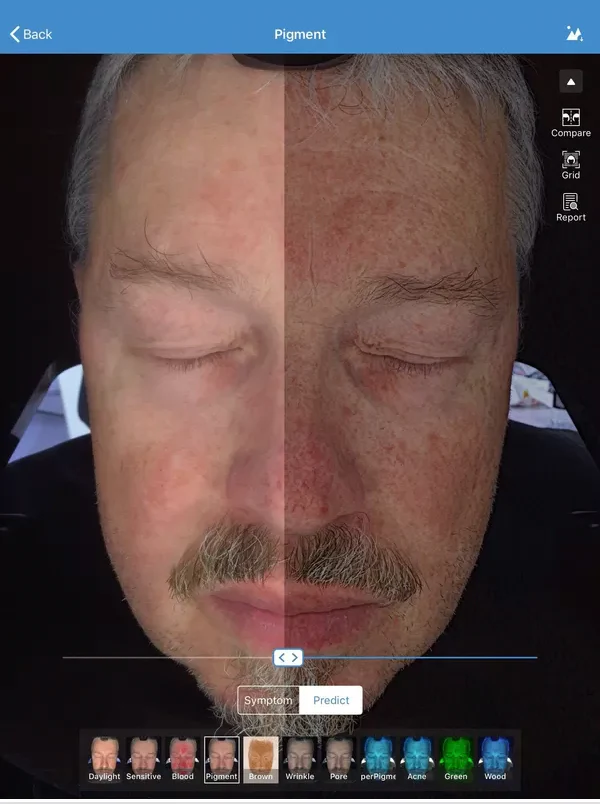 Skin Analyser - Diagnostic de Peau